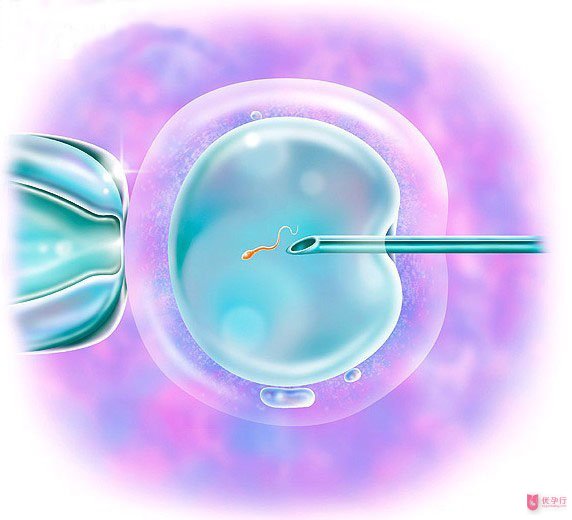 這些因素會影響試管嬰兒的胚胎質(zhì)量