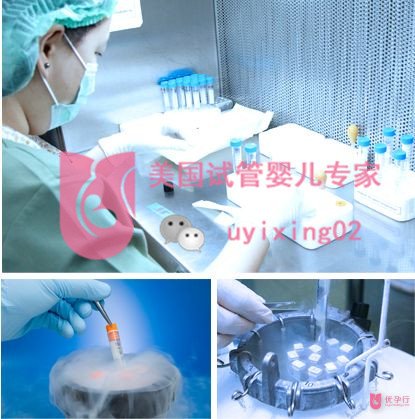 優(yōu)孕行全面揭秘：美國(guó)試管嬰兒成功率為何如此之高？