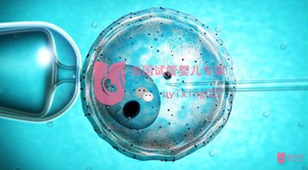 優(yōu)孕行全面揭秘：美國(guó)試管嬰兒成功率為何如此之高？