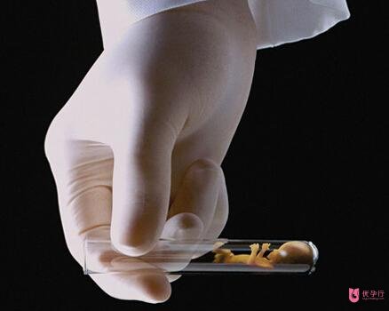 去美國做試管嬰兒價格怎么樣？