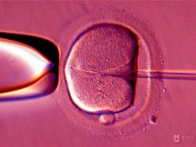 俄羅斯試管嬰兒方案，讓多次試管失敗的家庭重獲希望！