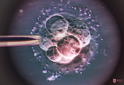 俄羅斯試管專家告訴你大齡難孕怎么辦?優(yōu)孕行整理