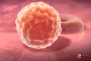 俄羅斯試管專家告訴你大齡難孕怎么辦?優(yōu)孕行整理