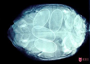 俄羅斯做試管嬰兒的費用要多少？都包括哪些？