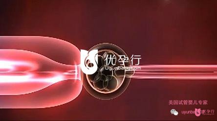 美國(guó)試管嬰兒
