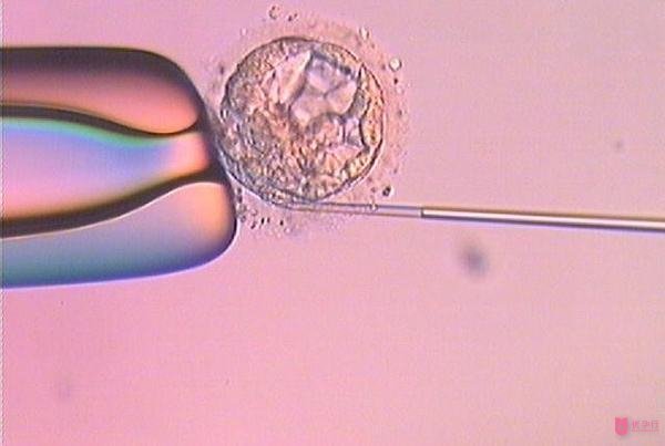 美國(guó)試管嬰兒