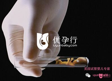 美國(guó)試管嬰兒