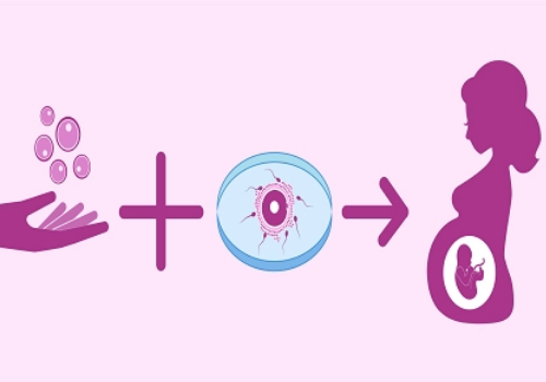 美國(guó)試管嬰兒的過程是什么