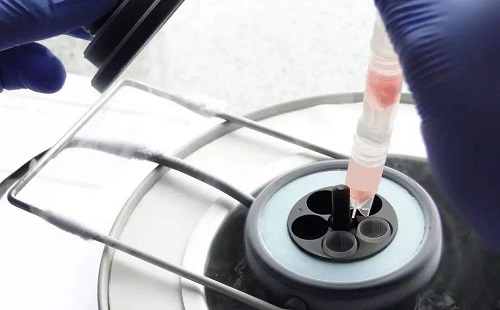 去美國(guó)做試管嬰兒的費(fèi)用