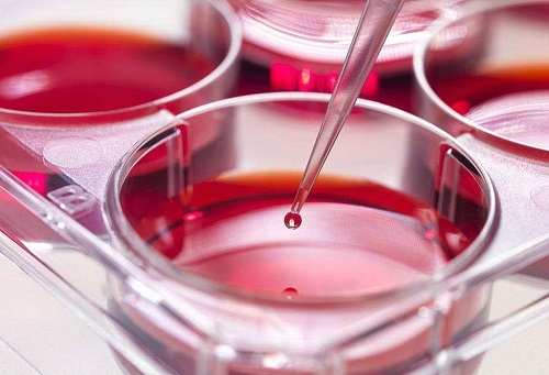 泰國(guó)試管費(fèi)用比單胎更貴嗎