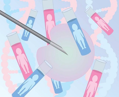 俄羅斯第三代試管嬰兒費用包含幾部分