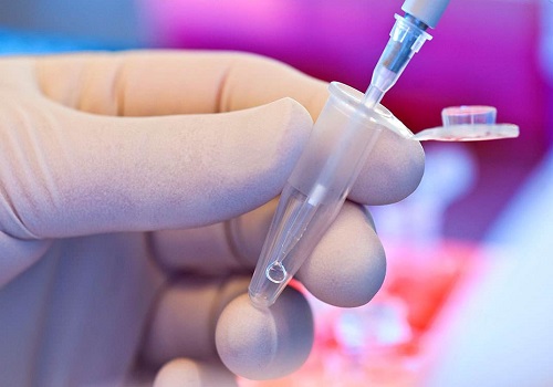 美國做試管的費用標準介紹