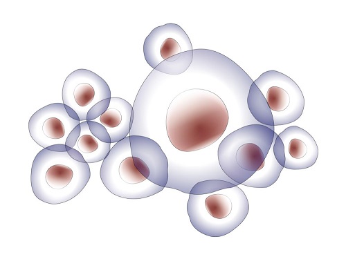 第一次去俄羅斯做試管嬰兒花費(fèi)有哪些