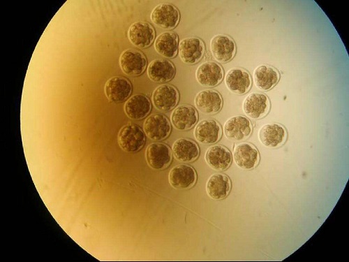 俄羅斯試管嬰兒醫(yī)院大比拼,哪家性價(jià)比高一目了然!