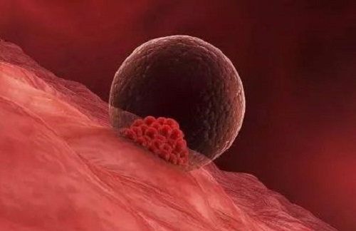 俄羅斯試管嬰兒成功率到底有多高