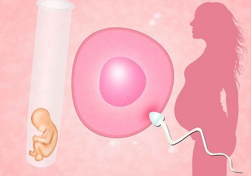 美國(guó)試管費(fèi)用是多少錢(qián)??？