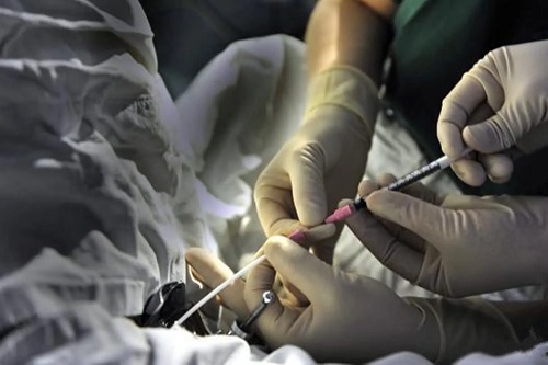 嬰兒試管俄羅斯，俄羅斯三代試管嬰兒優(yōu)勢(shì)與注意事項(xiàng)？